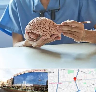 دکتر نورولوژی در نصف راه تبریز