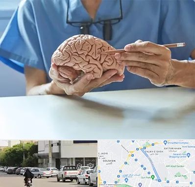 دکتر نورولوژی در قدوسی شرقی شیراز 