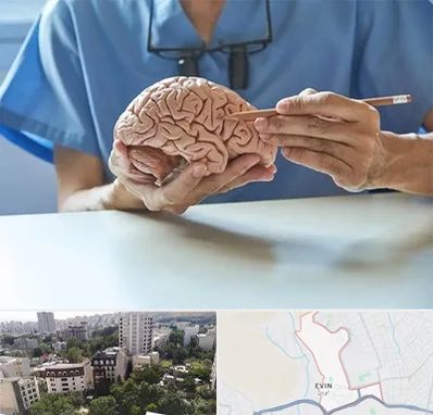 دکتر نورولوژی در اوین