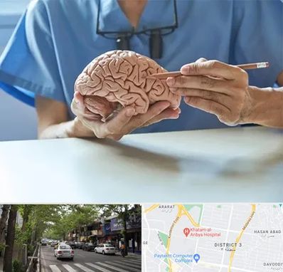 دکتر نورولوژی در ظفر 