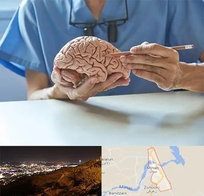 دکتر نورولوژی در میناب