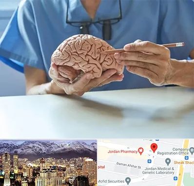 دکتر نورولوژی در جردن 