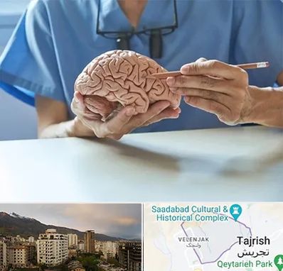 دکتر نورولوژی در زعفرانیه 