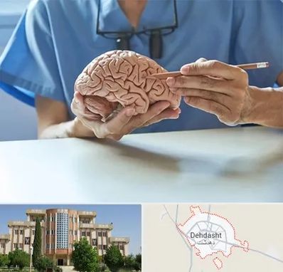دکتر نورولوژی در دهدشت