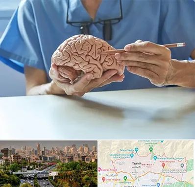 دکتر نورولوژی در منطقه 1 تهران 