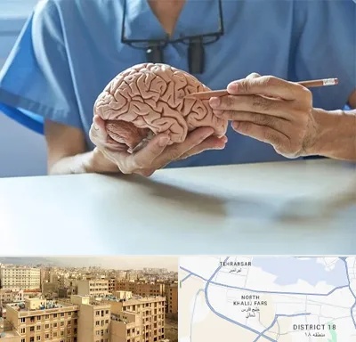دکتر نورولوژی در جنوب غرب تهران