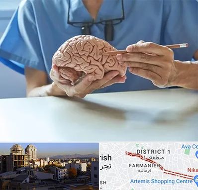 دکتر نورولوژی در فرمانیه 