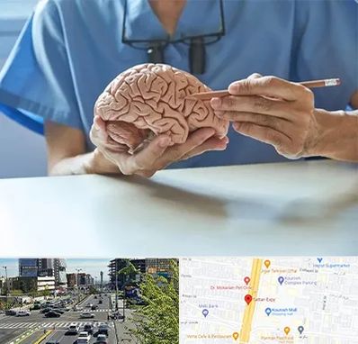 دکتر نورولوژی در ستاری 