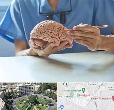 دکتر نورولوژی در جهانشهر کرج 