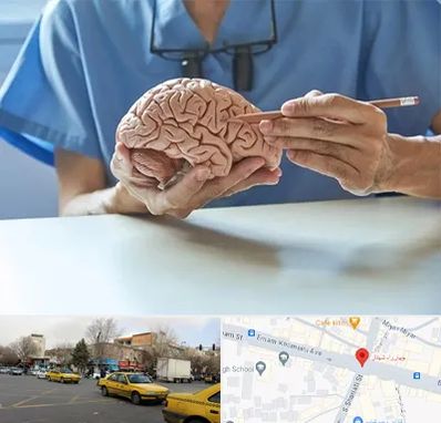 دکتر نورولوژی در شهناز تبریز