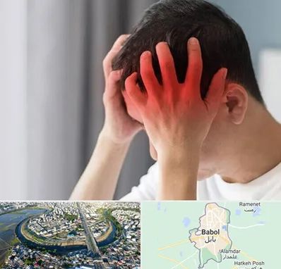 دکتر میگرن در بابل