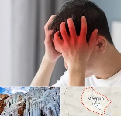 دکتر میگرن در میگون