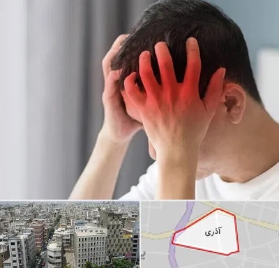 دکتر میگرن در آذری
