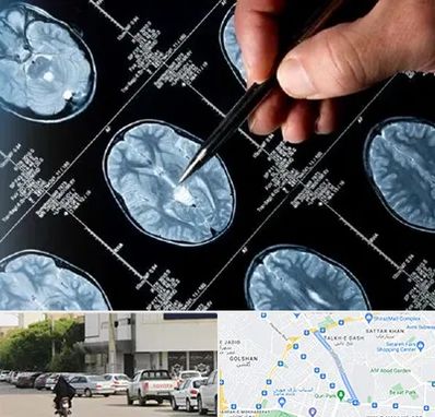 دکتر تشنج در قدوسی شرقی شیراز 