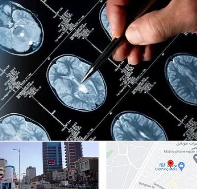 دکتر تشنج در چهارراه طالقانی کرج 