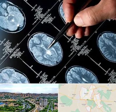 دکتر تشنج در شهریار