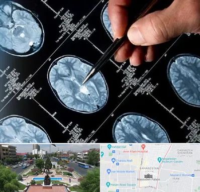 دکتر تشنج در بهارستان 