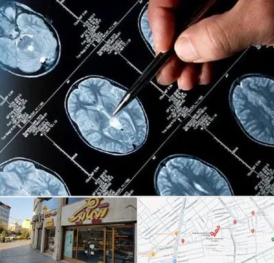 دکتر تشنج در عطاران قم