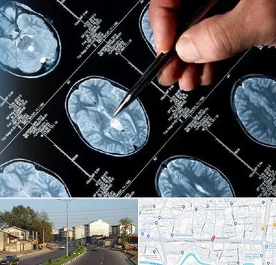 دکتر تشنج در ضیابری رشت 