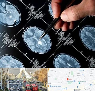 دکتر تشنج در خیابان آزادی 