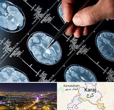 دکتر تشنج در کرج