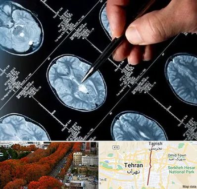 دکتر تشنج در ولیعصر 