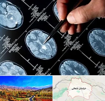 دکتر تشنج در خراسان شمالی