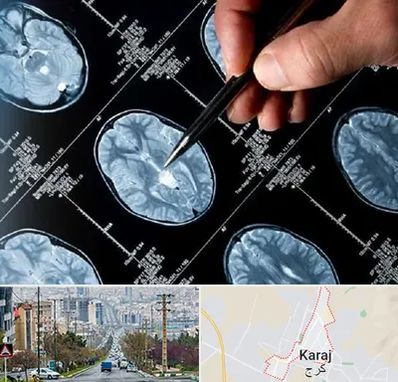 دکتر تشنج در گوهردشت کرج 