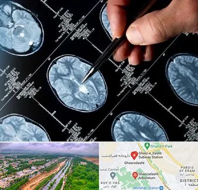 دکتر تشنج در قصرالدشت شیراز 