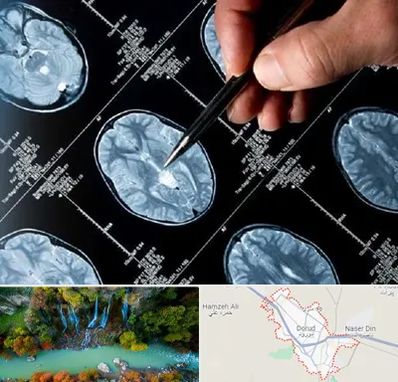 دکتر تشنج در دورود