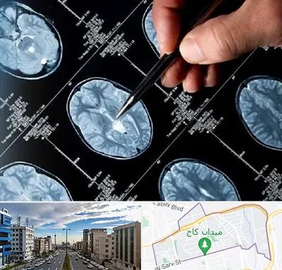 دکتر تشنج در سعادت آباد 