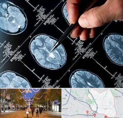 دکتر تشنج در ولیعصر ارومیه