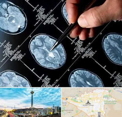 دکتر تشنج در تهران