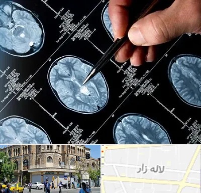 دکتر تشنج در لاله زار