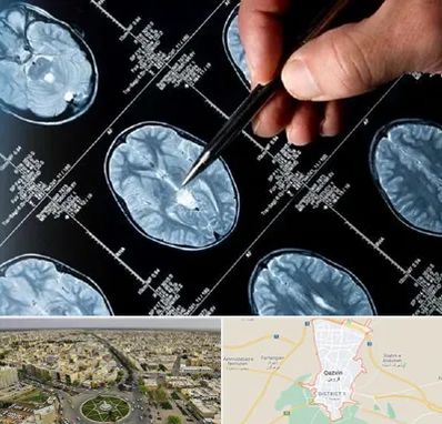 دکتر تشنج در قزوین