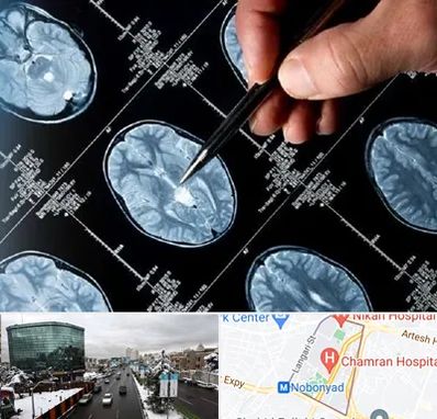 دکتر تشنج در اقدسیه 