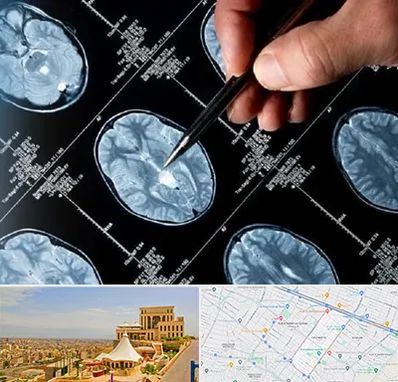 دکتر تشنج در هاشمیه مشهد 