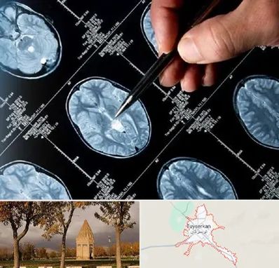 دکتر تشنج در تویسرکان
