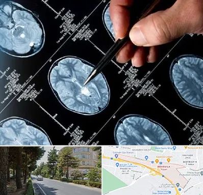 دکتر تشنج در مهرویلا کرج 