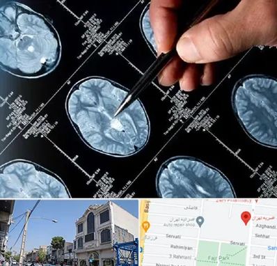 دکتر تشنج در افسریه 