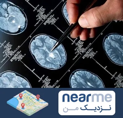 دکتر تشنج در نزدیک من