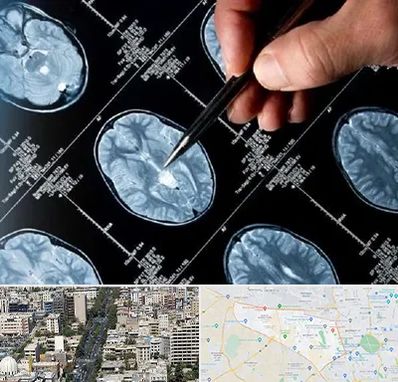 دکتر تشنج در منطقه 18 تهران