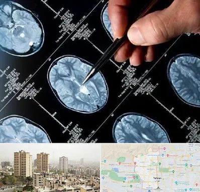 دکتر تشنج در منطقه 5 تهران
