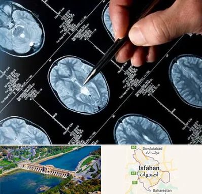 دکتر تشنج در اصفهان