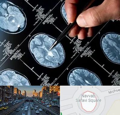 دکتر تشنج در نواب 