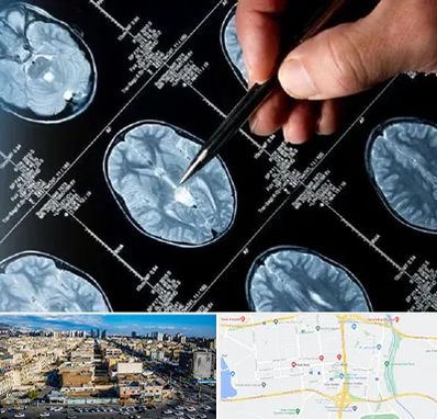 دکتر تشنج در شهرک راه آهن 