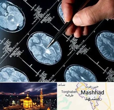 دکتر تشنج در مشهد