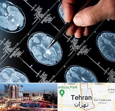 دکتر تشنج در صادقیه 