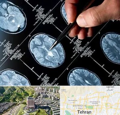 دکتر تشنج در شمال تهران 