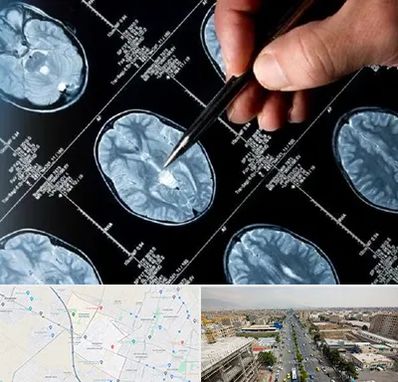 دکتر تشنج در حصارک کرج 